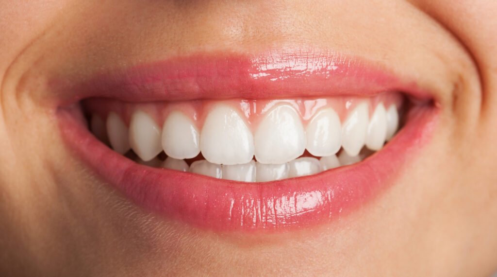 perfect smile